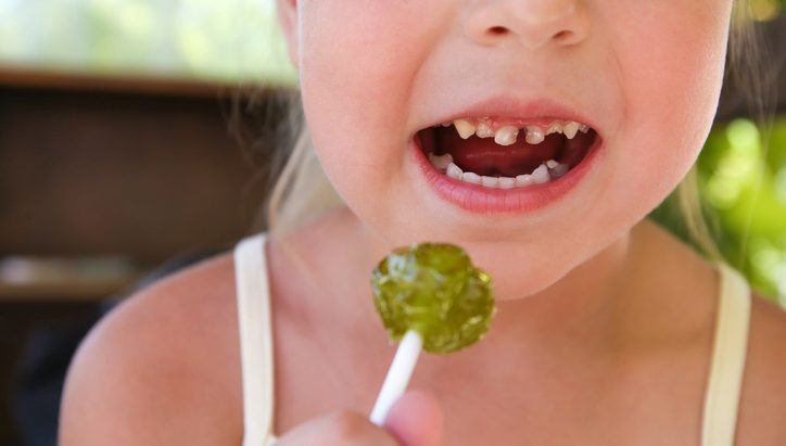 dientes negros niños