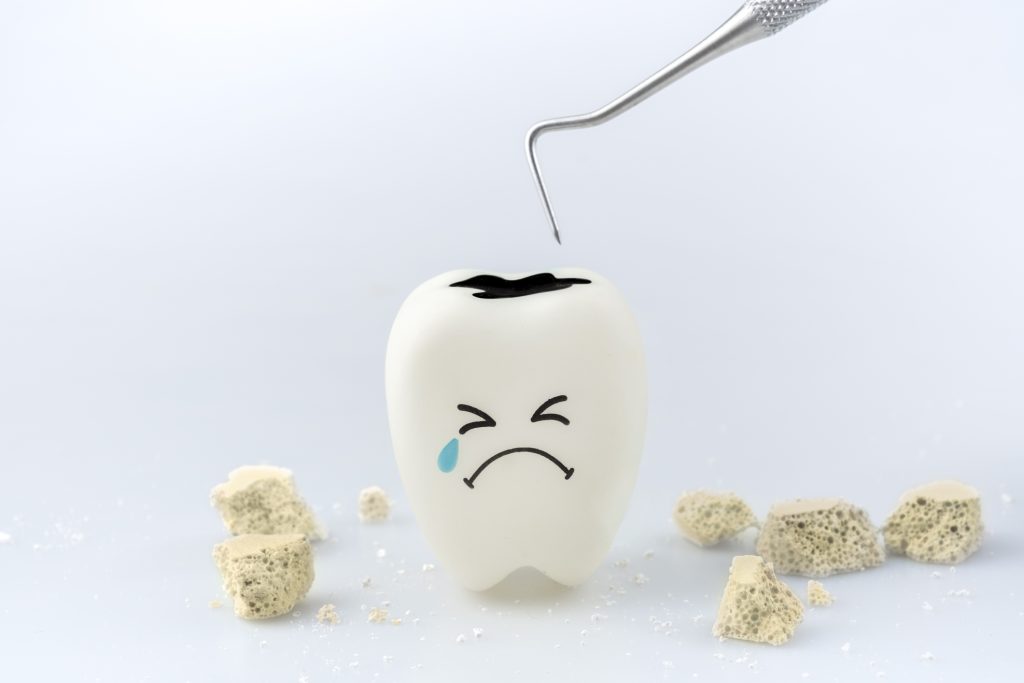 caries sin dolor