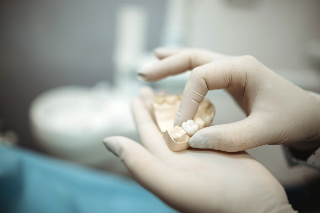 cuánto tiempo duran los implantes dentales