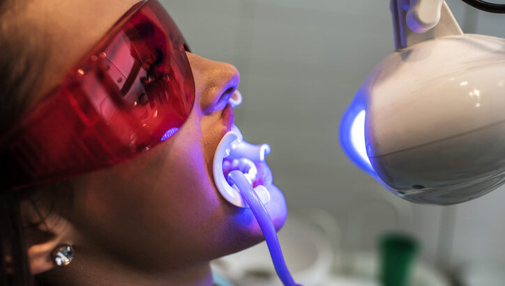 hábitos que debes evitar después de un blanqueamiento dental