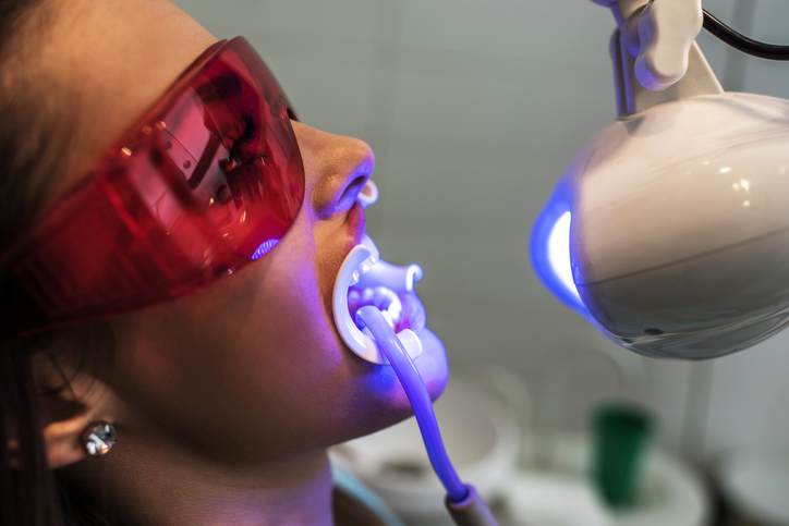 hábitos que debes evitar después de un blanqueamiento dental