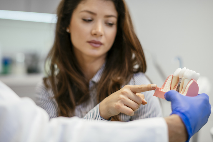 implantes dentales