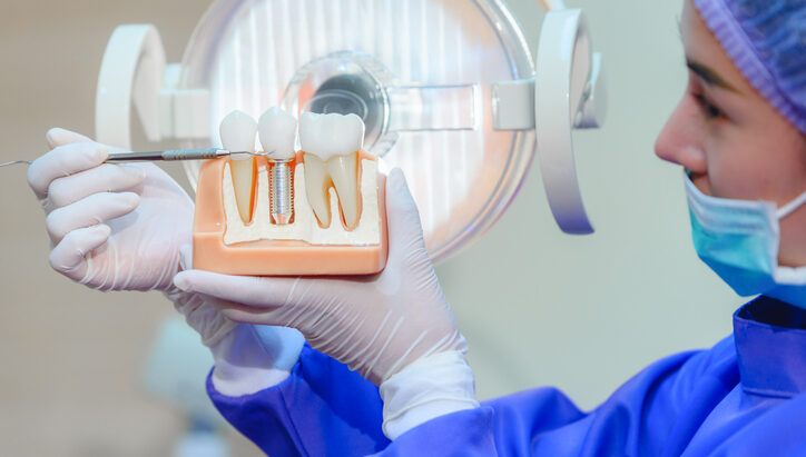 rechazo de implante dental