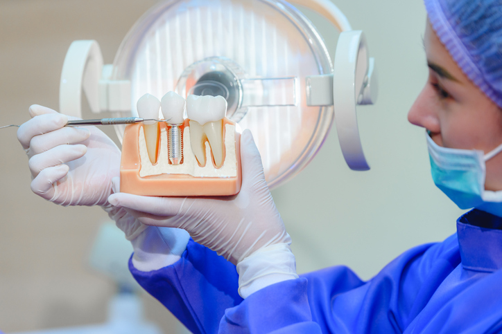 rechazo de implante dental