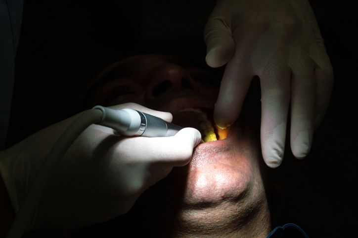desgaste dental