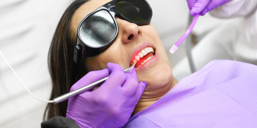 láser dental